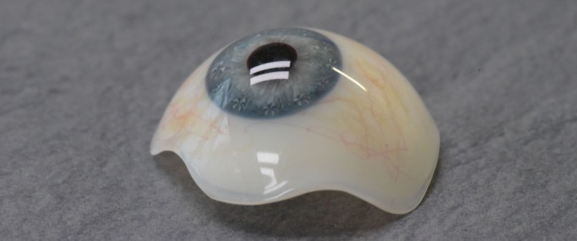 Scleral shell